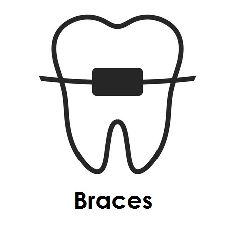 Cosmetic Braces