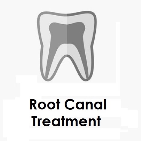 Root Canal Treatment